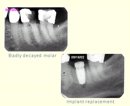 Belmont Periodontics