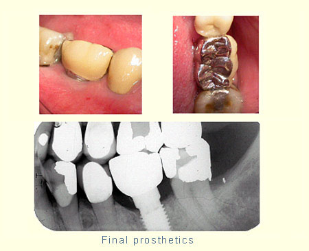 Belmont Periodontics