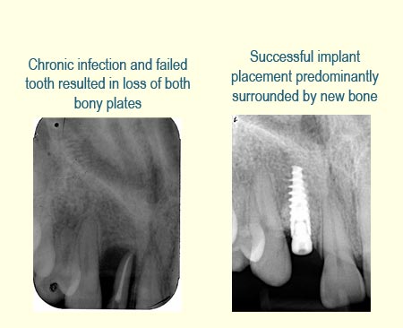 Belmont Periodontics