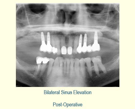 Belmont Periodontics