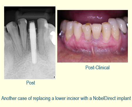 Belmont Periodontics