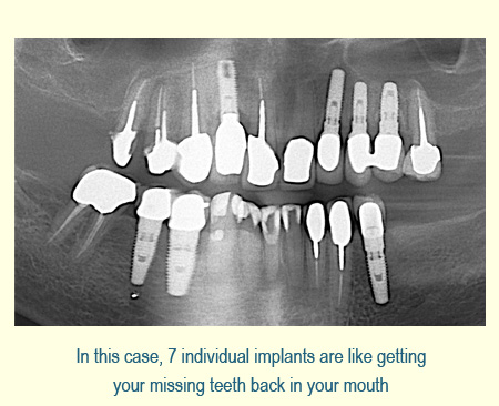 Belmont Periodontics