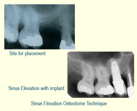 Belmont Periodontics