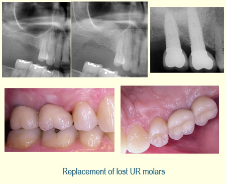 Belmont Periodontics