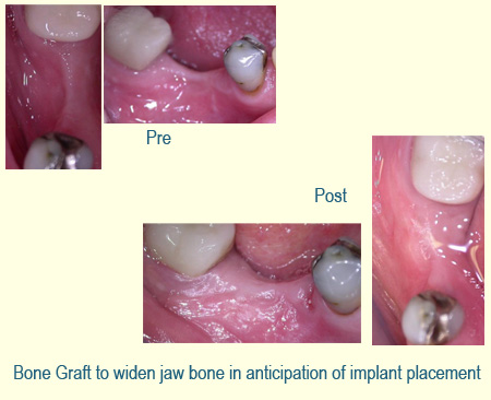 Belmont Periodontics